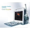 Portable Color Doppler Ultrasonic Diagnostic System